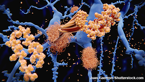 amyloid accumulation in the brain